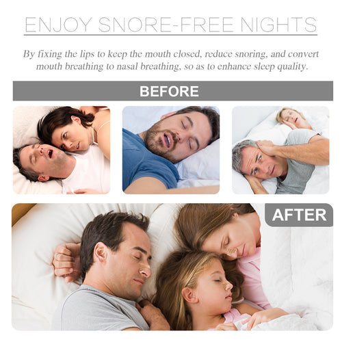 Anti-snoring Nasal Strips- Breathe Better & Sleep Deeper Instantly